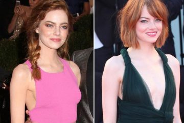 Best and Worst Celebrity Transformations